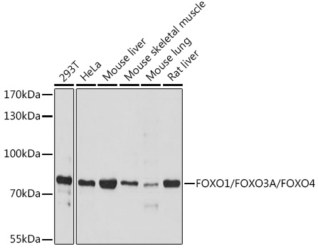 Western blot analysis of various lysates using FOXO1/FOXO3A/FOXO4 Rabbit pAb at 1:1000 dilution.
Secondary antibody: HRP-conjugated Goat anti-Rabbit IgG (H+L)  at 1:10000 dilution.
Lysates/proteins: 25μg per lane.
Blocking buffer: 3% nonfat dry milk in TBST.
Detection: ECL West Pico Plus.
Exposure time: 180s.