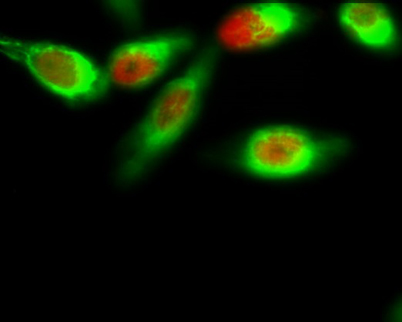Immunofluorescence analysis of Hela cell. 1,FoxO1 (phospho Ser256) Polyclonal Antibody(red) was diluted at 1:200(4° overnight). Active Caspase-3 Monoclonal Antibody(5E1)(green) was diluted at 1:200(4° overnight). 2, Goat Anti Rabbit Alexa Fluor 594 Catalo