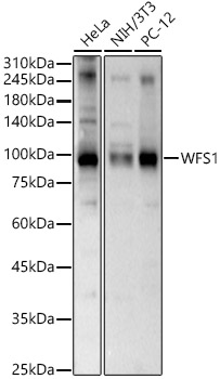 Western blot analysis of various lysates, using WFS1 Rabbit pAb at 1:1000 dilution.
Secondary antibody: HRP-conjugated Goat anti-Rabbit IgG (H+L) at 1:10000 dilution.
Lysates/proteins: 25μg per lane.
Blocking buffer: 3% nonfat dry milk in TBST.
Detection: ECL West Pico Plus.
Exposure time: 60s.