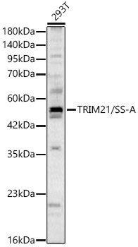 Western blot analysis of lysates from 293T cells, using TRIM21/SS-A Rabbit pAb  at 1:2000 dilution.
Secondary antibody: HRP-conjugated Goat anti-Rabbit IgG (H+L) at 1:10000 dilution.
Lysates/proteins: 25μg per lane.
Blocking buffer: 3% nonfat dry milk in TBST.
Detection: ECL West Pico Plus. 
Exposure time: 90s.