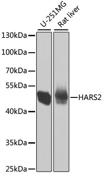 Western blot analysis of various lysates using HARS2 Rabbit pAb at 1:1000 dilution.
Secondary antibody: HRP-conjugated Goat anti-Rabbit IgG (H+L) at 1:10000 dilution.
Lysates/proteins: 25μg per lane.
Blocking buffer: 3% nonfat dry milk in TBST.
Detection: ECL West Pico Plus.
Exposure time: 5s.
