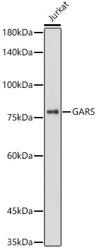 Western blot analysis of lysates from Jurkat cells, using [KO Validated] GARS Rabbit mAb  at 1:1000 dilution.
Secondary antibody: HRP-conjugated Goat anti-Rabbit IgG (H+L)  at 1:10000 dilution.
Lysates/proteins: 25μg per lane.
Blocking buffer: 3% nonfat dry milk in TBST.
Detection: ECL West Pico Plus.
Exposure time: 180s.