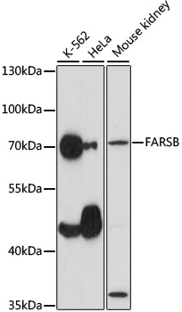 Western blot analysis of various lysates using FARSB Rabbit pAb at 1:1000 dilution.
Secondary antibody: HRP-conjugated Goat anti-Rabbit IgG (H+L) at 1:10000 dilution.
Lysates/proteins: 25μg per lane.
Blocking buffer: 3% nonfat dry milk in TBST.
Detection: ECL West Pico Plus.
Exposure time: 30s.