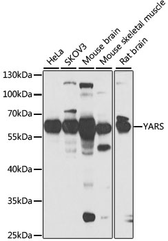 Western blot analysis of various lysates using YARS Rabbit pAb ) at 1:1000 dilution.
Secondary antibody: HRP-conjugated Goat anti-Rabbit IgG (H+L) at 1:10000 dilution.
Lysates/proteins: 25μg per lane.
Blocking buffer: 3% nonfat dry milk in TBST.
Detection: ECL West Pico Plus.
Exposure time: 30s.
