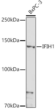 Western blot analysis of lysates from BxPC-3 cells, using IFIH1 Rabbit pAb at 1:1000 dilution.
Secondary antibody: HRP-conjugated Goat anti-Rabbit IgG (H+L) at 1:10000 dilution.
Lysates/proteins: 25μg per lane.
Blocking buffer: 3% nonfat dry milk in TBST.
Detection: ECL West Pico Plus.
Exposure time: 180s.