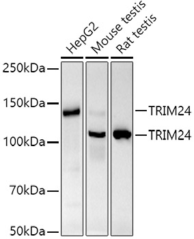 Western blot analysis of various lysates using TRIM24 Rabbit mAb at 1:1000 dilution.
Secondary antibody: HRP-conjugated Goat anti-Rabbit IgG (H+L) at 1:10000 dilution.
Lysates/proteins: 25μg per lane.
Blocking buffer: 3% nonfat dry milk in TBST.
Detection: ECL West Pico Plus.
Exposure time: 60s.