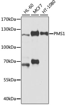 Western blot analysis of various lysates using PMS1 Rabbit pAb at 1:1000 dilution.
Secondary antibody: HRP-conjugated Goat anti-Rabbit IgG (H+L) at 1:10000 dilution.
Lysates/proteins: 25μg per lane.
Blocking buffer: 3% nonfat dry milk in TBST.
Detection: ECL West Pico Plus.
Exposure time: 5s.