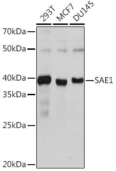 Western blot analysis of various lysates using SAE1 Rabbit mAb  at 1:1000 dilution.
Secondary antibody: HRP-conjugated Goat anti-Rabbit IgG (H+L) at 1:10000 dilution.
Lysates/proteins: 25μg per lane.
Blocking buffer: 3% nonfat dry milk in TBST.
Detection: ECL West Pico Plus.
Exposure time: 1s.