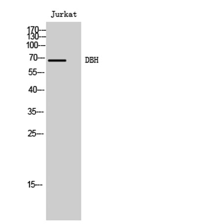Western Blot analysis of Jurkat cells using DBH Polyclonal Antibody