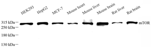 WB analysis of mTOR Sample: Protein treated by RIPA Lysis Buffer .Blocking buffer: 3% Nonfat dry milk in TBST, RT, 1h.Primary antibody: 1: 1000, 4℃ overnight.Secondary antibody: HRP conjugated Goat Anti-Rabbit lgG , 1: 3000, RT, 1h.