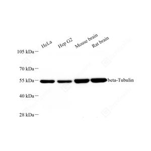 WB analysis of beta Tubulin.Sample: Protein treated by RIPA Lysis Buffer .Blocking buffer: 3% Nonfat dry milk in TBST, RT, 1h.Antibody: HRP conjugated anti-beta Tubulin antibody 1: 2000, 4℃ overnight.