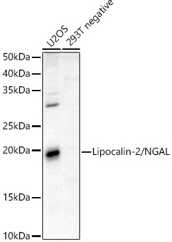 Western blot analysis of various lysates using Lipocalin-2/NGAL Rabbit pAb  at 1:500 dilution.
Secondary antibody: HRP-conjugated Goat anti-Rabbit IgG (H+L) (AS014) at 1:10000 dilution.
Lysates/proteins: 25μg per lane.
Blocking buffer: 3% nonfat dry milk in TBST.
Detection: ECL Basic Kit.
Exposure time: 60s.