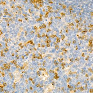 IHC analysis of PD1.Sample: Human tonsil, 4% PFA 12-24h.Antigen retrieval: Citrate buffer , pressure cooker 2 min.Primary antibody: 1: 1200, 4℃ overnight.Secondary antibody: HRP conjugated Goat Anti-Mouse lgG , 1: 200, RT, 1h.