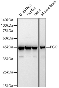 Western blot analysis of various lysates, using PGK1 Rabbit pAb at 1:400 dilution.
Secondary antibody: HRP-conjugated Goat anti-Rabbit IgG (H+L) (AS014) at 1:10000 dilution.
Lysates/proteins: 25μg per lane.
Blocking buffer: 3% nonfat dry milk in TBST.
Detection: ECL Basic Kit (RM00020).
Exposure time: 60s.