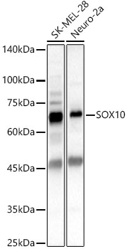 Western blot analysis of various lysates using SOX10 Rabbit pAb at 1:600 dilution.
Secondary antibody: HRP-conjugated Goat anti-Rabbit IgG (H+L) at 1:10000 dilution.
Lysates / proteins: 25 μg per lane.
Blocking buffer: 3 % nonfat dry milk in TBST.
Detection: ECL West Pico Plus.
Exposure time: 20s.