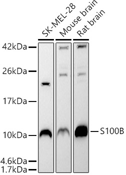 Western blot analysis of various lysates using S100B Rabbit pAb at 1:500 dilution.
Secondary antibody: HRP-conjugated Goat anti-Rabbit IgG (H+L)at 1:10000 dilution.
Lysates / proteins: 25 μg per lane.
Blocking buffer: 3 % nonfat dry milk in TBST.
Detection: ECL West Pico Plus.
Exposure time: 90s.