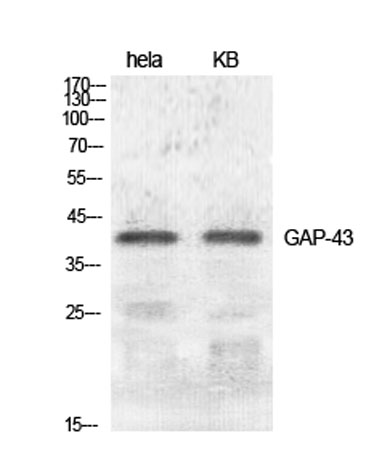 Western Blot analysis of various cells using GAP-43 Polyclonal Antibody diluted at 1:500