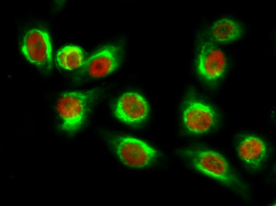 Immunofluorescence analysis of Hela cell. 1,NFκB-p65 (Acetyl Lys310) Polyclonal Antibody(red) was diluted at 1:200(4° overnight). β-Tubulin Monoclonal Antibody(5G3)(green) was diluted at 1:200(4° overnight). 2, Goat Anti Rabbit Alexa Fluor 594.