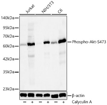 Western blot analysis of lysates from Jurkat,NIH/3T3,C6 cells using Phospho-Akt-S473 Rabbit mAb  at 1:1000 dilution. Jurkat,NIH/3T3 and C6 cells were treated by Calyculin A  at 37℃ for 30 minutes.
Secondary antibody: HRP-conjugated Goat anti-Rabbit IgG   at 1:10000 dilution.
Lysates/proteins: 25 μg per lane.
Blocking buffer: 3% nonfat dry milk in TBST.
Detection: ECL Basic Kit .
Exposure time: 20s.