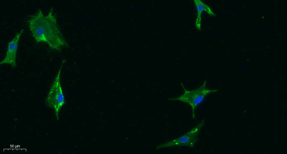 Immunofluorescence analysis of A549. 1,primary Antibody was diluted at 1:200(4°C overnight). 2, Goat Anti Rabbit IgG (H&L) - Alexa Fluor 488 Secondary antibody was diluted at 1:1000(room temperature, 50min).3, Picture B: DAPI(blue) 10min.