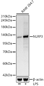 Western blot analysis of lysates from RAW 264.7 cells, using NLRP3 Rabbit mAb at 1:1000 dilution. Raw264. 7 cells were treated with LPS (1 μg/ml) at 37℃ for 8 hours.
Secondary antibody: HRP-conjugated Goat anti-Rabbit IgG (H+L) ) at 1:10000 dilution.
Lysates/proteins: 25μg per lane.
Blocking buffer: 3% nonfat dry milk in TBST.
Detection: ECL West Pico Plus.
Exposure time: 10s.