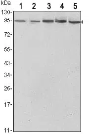 Western blot analysis using STAT3 mouse mAb against Hela (1),NIH/3T3 (2), Jurkat (3), PC-12 (4) and COS7 (5) cell lysate.