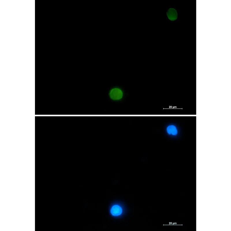 Immunocytochemistry analysis of Ubiquitin (green) in CEM using Ubiquitin antibody,and DAPI(blue).