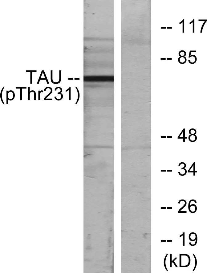Western blot analysis of lysates from MDA-MB-435 cells, using Tau （Phospho-Thr231） Antibody. The lane on the right is blocked with the phospho peptide.
