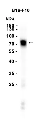 Western blot analysis of extracts from B16-F10 cells using TYRP1 Rabbit Monoclonal
Antibody at 1:5000