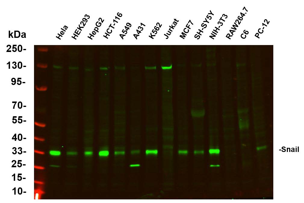 Various whole cell lysates were separated by 4-20% SDS-PAGE, and the primary
antibody was used at 4℃, over night with a 1:5000 dilution .