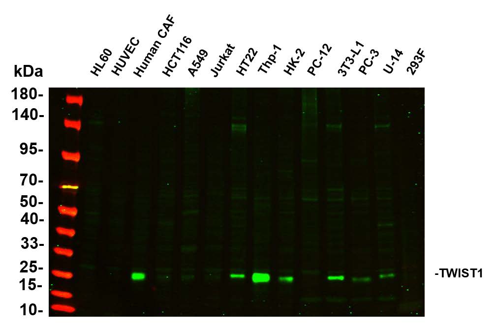Various whole cell lysates were separated by 4-20% SDS-PAGE, and the primary antibody was used at 4℃, over night with a 1:5000 dilution .