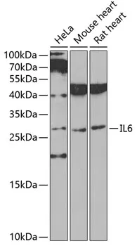 Western blot analysis of IL-6 in various cell lines lysates using IL-6 antibody.