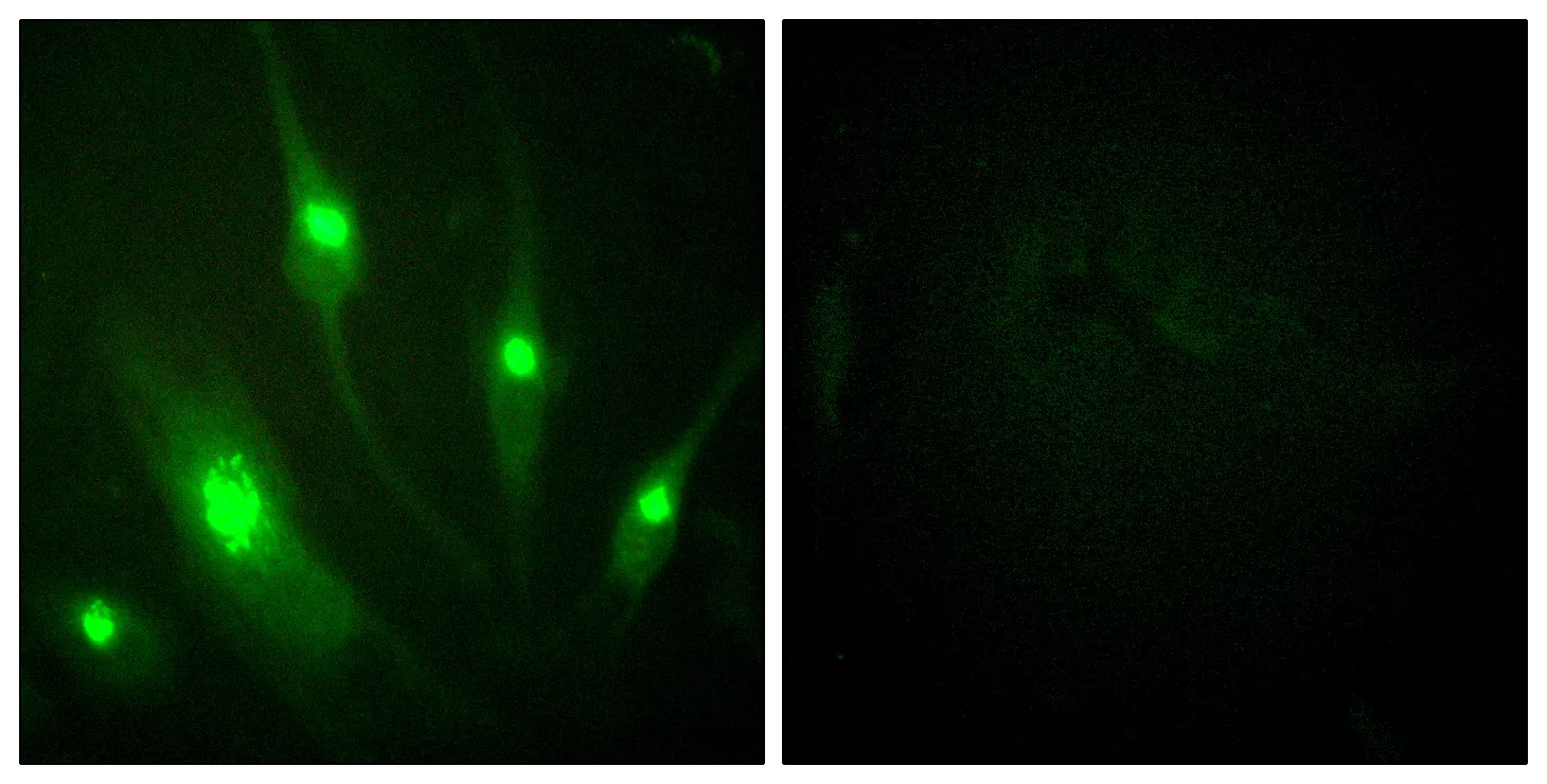 Immunofluorescence analysis of HeLa cells, using GTPase Activating Protein
Antibody. The picture on the right is blocked with the synthesized peptide.