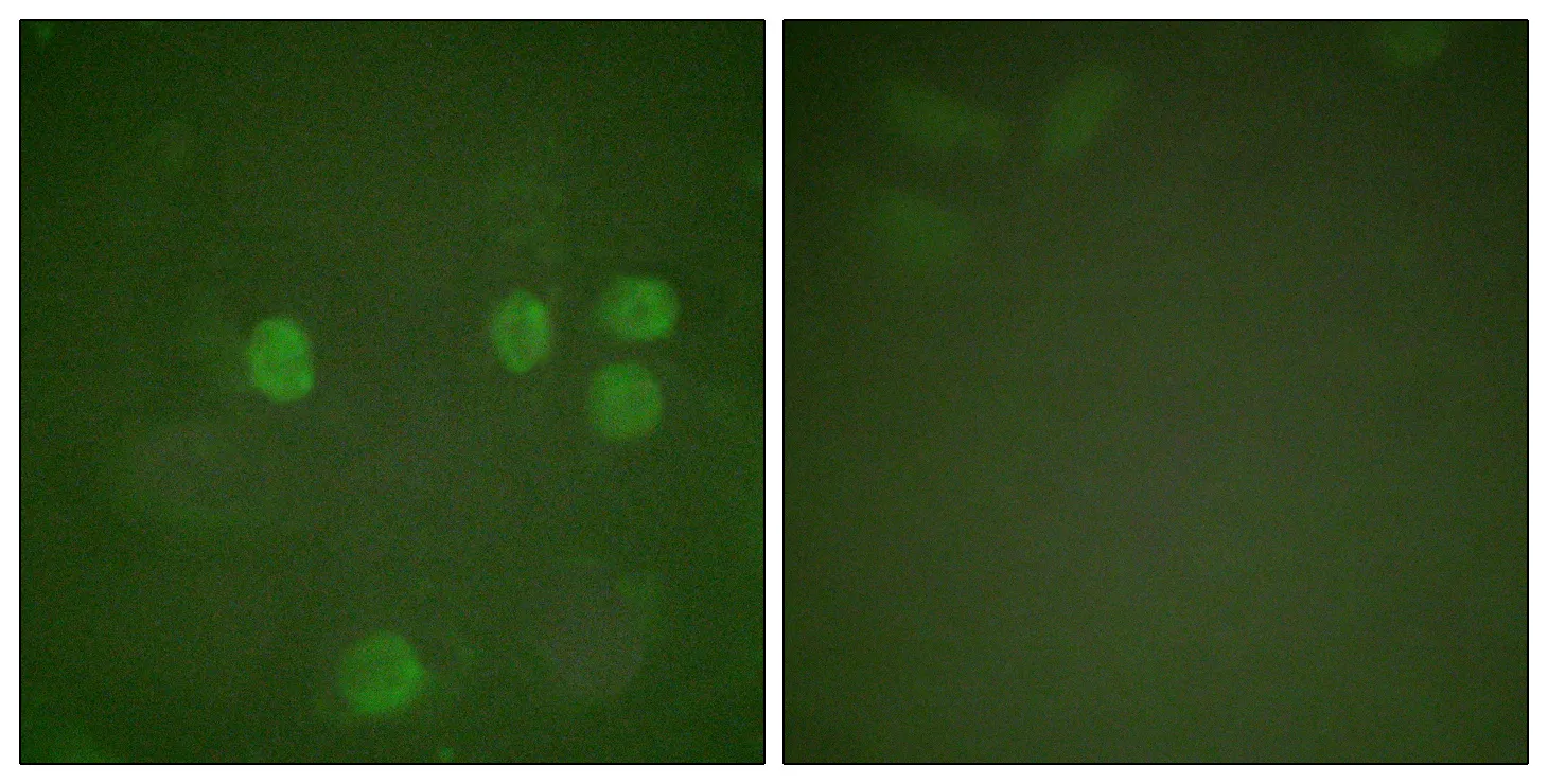 Immunofluorescence analysis of HeLa cells, using Cyclin B1 Antibody. The picture on the right is blocked with the synthesized peptide.