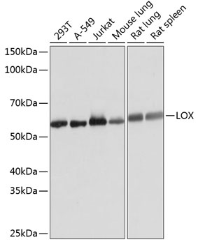 Western blot analysis of various lysates using LOX Rabbit mAb  at 1:1000 dilution.
Secondary antibody: HRP-conjugated Goat anti-Rabbit IgG (H+L) at 1:10000 dilution.
Lysates/proteins: 25μg per lane.
Blocking buffer: 3% nonfat dry milk in TBST.
Detection: ECL Basic Kit.
Exposure time: 1s.