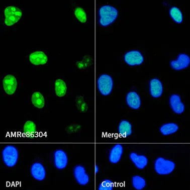 Immunofluorescence analysis of HeLa cells labelling Ki67 with Ki67 Rabbit Monoclonal Antibody.