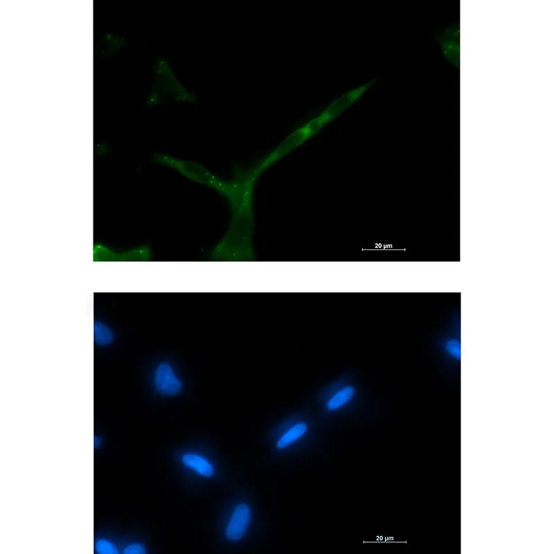 Immunocytochemistry analysis of APC (green) in LNcap using APC antibody, and DAPI (blue).