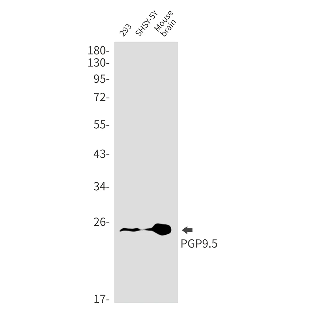 Western blot analysis of PGP9.5 in 293, SH-SY5Y, mouse brain lysates using PGP9.5 antibody.