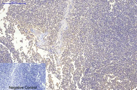 Immunohistochemistry analysis of paraffin-embedded Human Tonsil tissue using MAP2 (3B5) antibody. High-pressure and temperature Sodium Citrate pH 6.0 was used for antigen retrieval. Negative control was used by secondary antibody only.