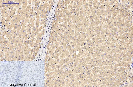 Immunohistochemical analysis of paraffin-embedded Human-liver tissue. 1,GFAP Monoclonal Antibody（5C8） was diluted at 1:200（4°C,overnight）. 2, Sodium citrate pH 6.0 was used for antibody retrieval（>98°C,20min）. 3,Secondary antibody was diluted at 1:200（room tempeRature, 30min）. Negative control was used by secondary antibody only.