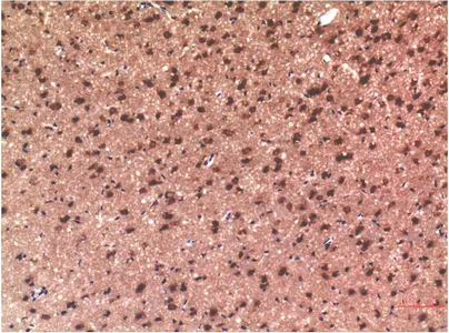 Immunohistochemical analysis of paraffin-embedded Rat Brain Tissue using Tau Mouse mAb diluted at 1:200