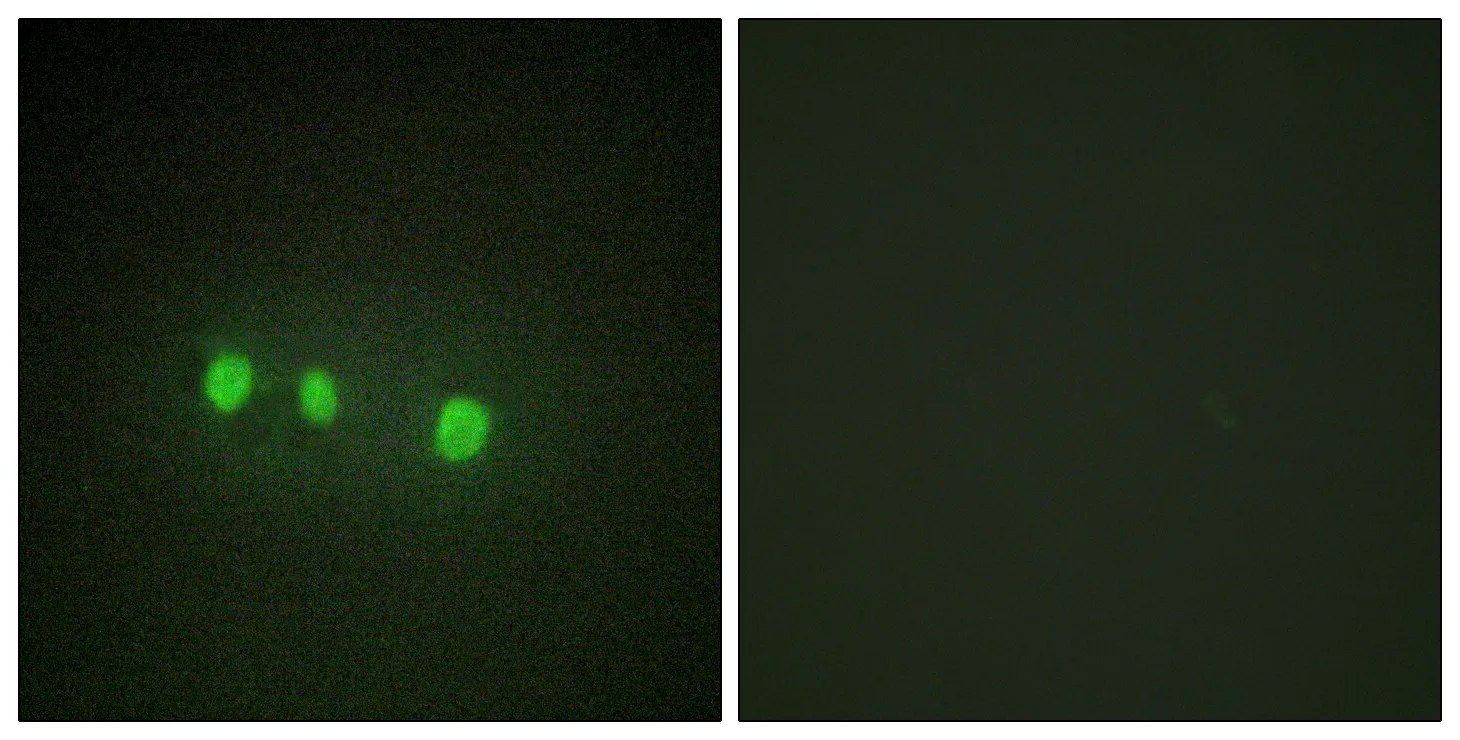 Immunofluorescence analysis of HepG2 cells, using ZIC1/2/3/4/5 Antibody. The picture on the right is blocked with the synthesized peptide.
