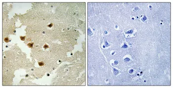 Immunohistochemical analysis of paraffin-embedded Human brain. Antibody was diluted at 1:100(4°,overnight). High-pressure and temperature Tris-EDTA,pH8.0 was used for antigen retrieval. Negetive contrl (right) obtaned from antibody was pre-absorbed by immunogen peptide.
