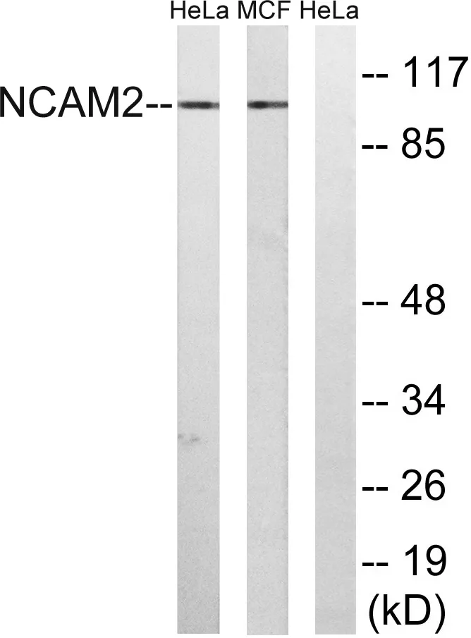 Western blot analysis of lysates from MCF-7 and HeLa cells, using NCAM2 Antibody. The lane on the right is blocked with the synthesized peptide.