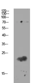 Western blot analysis of mouse-kidney lysate, antibody was diluted at 1000. Secondary antibody was diluted at 1:20000