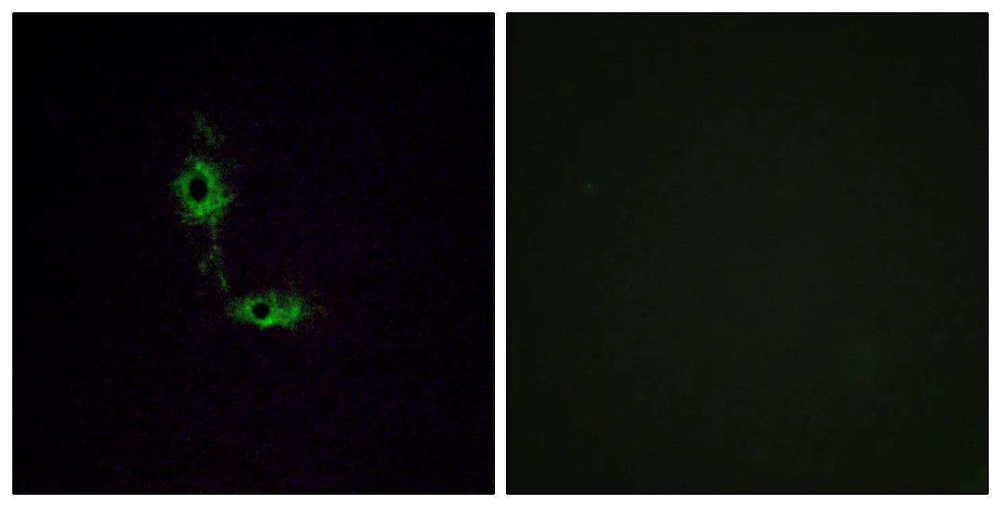 Immunofluorescence analysis of HeLa cells, using GluR1 Antibody. The picture on the right is blocked with the synthesized peptide.