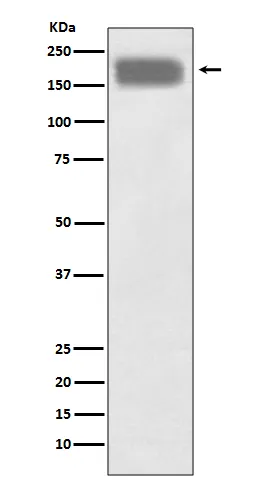 Western blot analysis of NCAM expression in SH-SY5Y cell lysate.