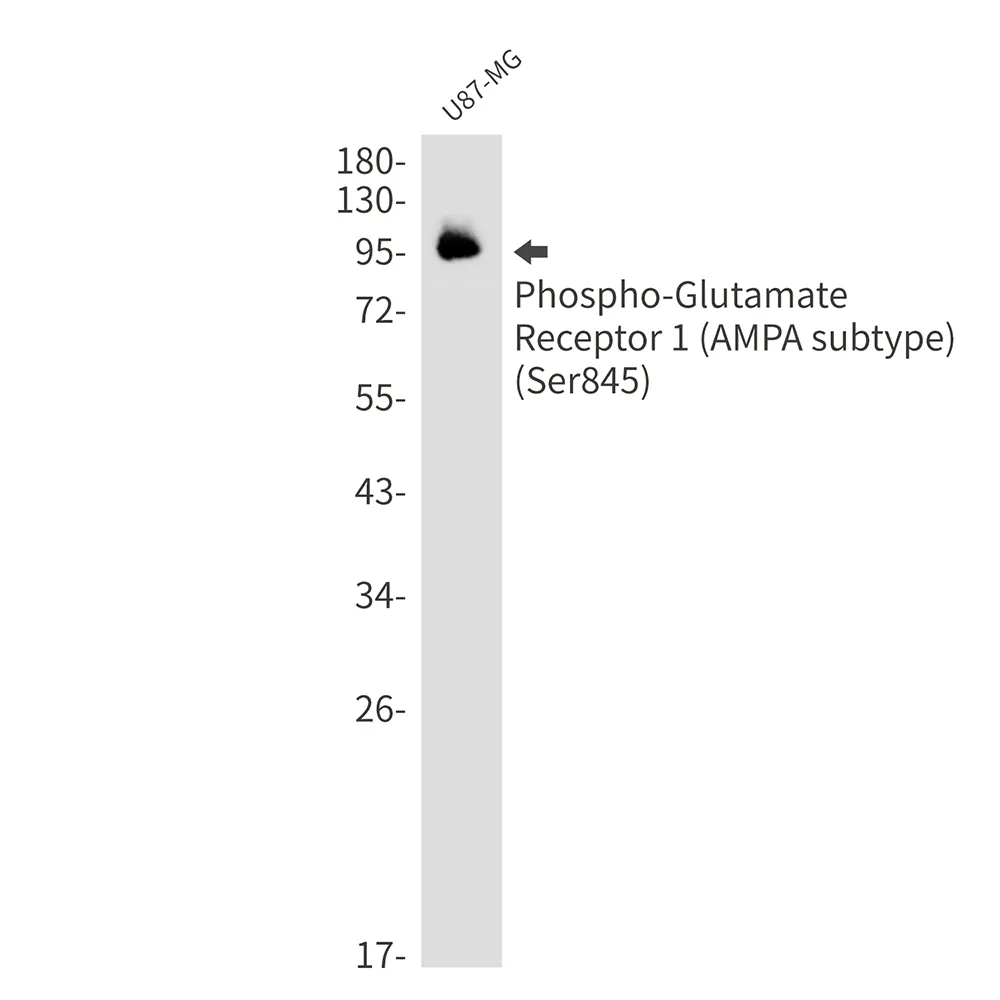 Western blot analysis of Phospho-Glutamate Receptor 1 (AMPA subtype) (Ser845) in U87-MG lysates using Phospho-Glutamate Receptor 1 (AMPA Subtype) (Ser845) antibody.