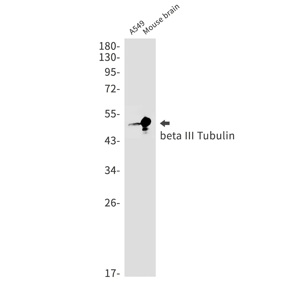 Western blot analysis of beta III Tubulin in A549, mouse brain lysates using beta III Tubulin antibody.
