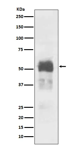 Western blot analysis of Tau expression in Mouse brain lysate.